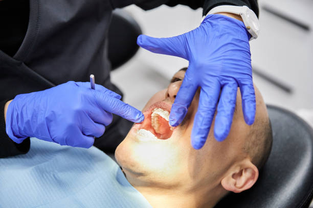 Best Emergency Treatment for Dental Infections or Abscesses in Perezville, TX